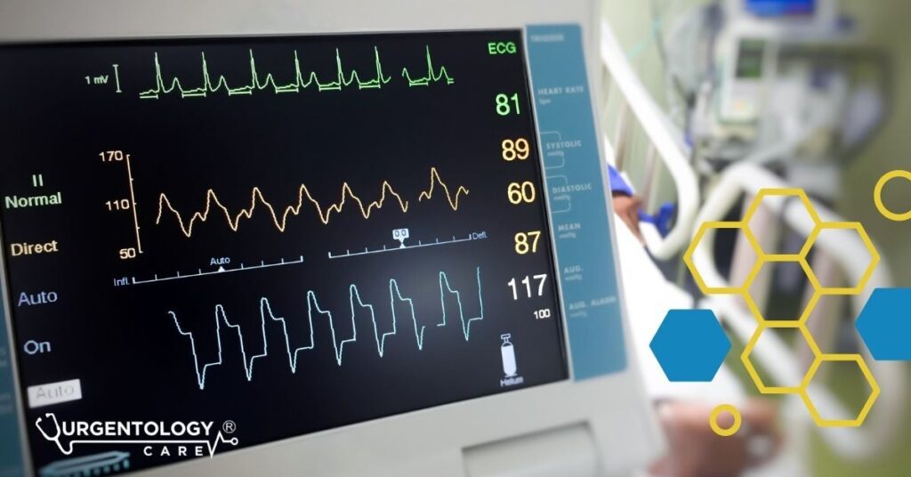ekg monitor